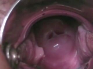 Cervikal orgasme in detail, gratis hd vies film video- 6f | xhamster